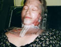 Picture showing the drilled radiotherapy mask with circles taken out.